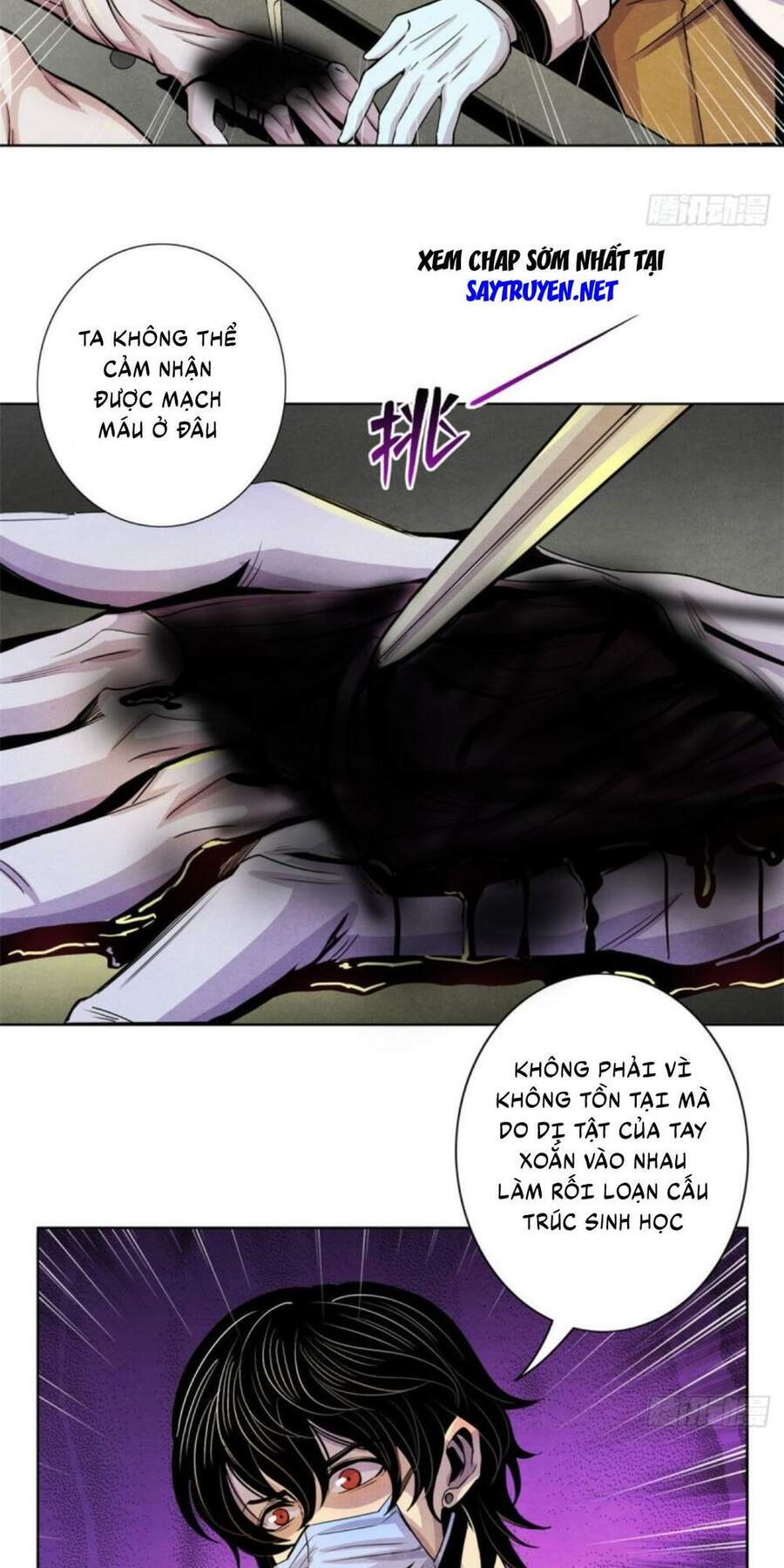 Bác Sĩ Hỗn Mang chapter 13 - Upload bởi truyensieuhay.com